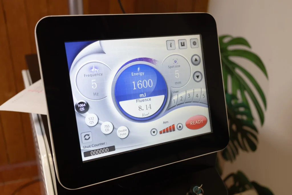 Pantalla táctil de control de un equipo láser para la eliminación de tatuajes mostrando parámetros de energía, frecuencia y fluence