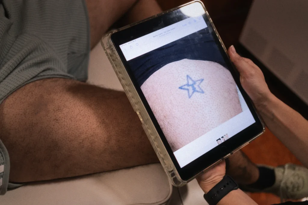 Tableta digital mostrando el registro fotográfico y el avance en el proceso de eliminación de un tatuaje con láser